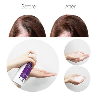 Шампунь для волос "Пептидный с кофеином", для глубокого очищения, питания и активного роста волос, Med:B MD:1 "Intensive Peptide Caffeine Shampoo", 300 мл, Корея